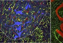 New injection technique may boost spinal cord injury repair efforts (Study) New injection technique may boost spinal cord injury repair efforts (Study)