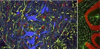 New injection technique may boost spinal cord injury repair efforts (Study) New injection technique may boost spinal cord injury repair efforts (Study)