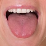 Research Finds Tongue Fat Can Lead to Sleep Apnea Research Finds Tongue Fat Can Lead to Sleep Apnea