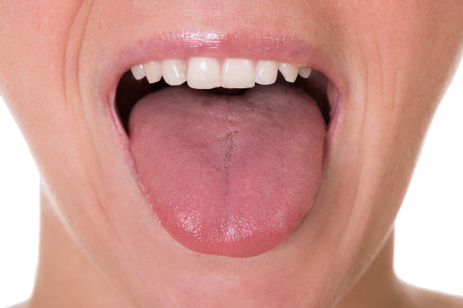 Research Finds Tongue Fat Can Lead to Sleep Apnea
