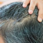 Stress and hair graying: Solving a biological puzzle (Study) Stress and hair graying: Solving a biological puzzle (Study)