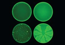 AI discovers antibiotic that kills even highly resistant bacteria (Study) AI discovers antibiotic that kills even highly resistant bacteria (Study)