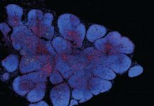 Report: Cell atlas of human thymus could help engineer improved therapeutic T cells Cell atlas of human thymus could help engineer