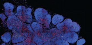 Report: Cell atlas of human thymus could help engineer improved therapeutic T cells Cell atlas of human thymus could help engineer
