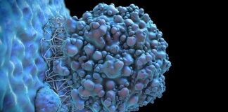 Combination Drug Therapy For Childhood Brain Tumors Shows Promise In Laboratory Models Combination Drug Therapy For Childhood Brain Tumors Shows Promise In Laboratory Models