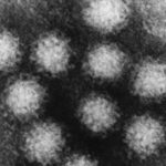 Norovirus outbreak in Louisiana casino leaves 200 ill, Report Norovirus outbreak in Louisiana casino leaves 200 ill, Report