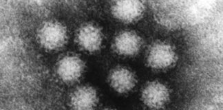 Norovirus outbreak in Louisiana casino leaves 200 ill, Report Norovirus outbreak in Louisiana casino leaves 200 ill, Report