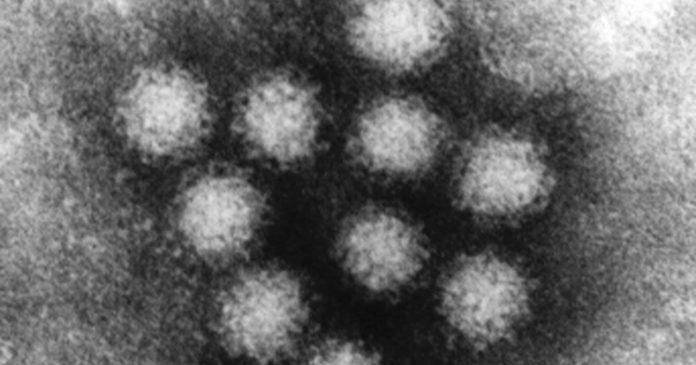 Norovirus outbreak in Louisiana casino leaves 200 ill, Report