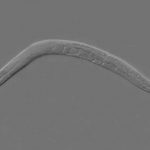 Report: Antioxidant reverses BPD-induced fertility damage in worms Report: Antioxidant reverses BPD-induced fertility damage in worms