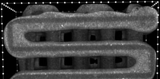 Report: Bioengineers 3D-print implants to seed multiple layers of tissue Report: Bioengineers 3D-print implants to seed multiple layers of tissue