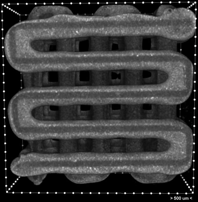 Report: Bioengineers 3D-print implants to seed multiple layers of tissue