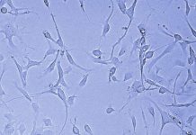 Researchers find ally in fight against brain tumors: Ebola Researchers find ally in fight against brain tumors: Ebola