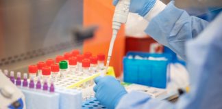 Coronavirus testing kits will be developed (Study) Coronavirus testing kits will be developed (Study)