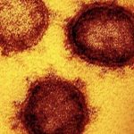 MU employees diagnosed with COVID-19 MU employees diagnosed with COVID-19