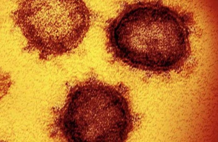 MU employees diagnosed with COVID-19