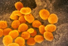 Research reveals how long COVID-19 remains infectious on cardboard, metal and plastic Research reveals how long COVID-19 remains infectious on cardboard, metal and plastic