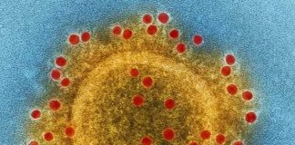 Study: COVID-19, not ‘just a flu’ Study: COVID-19, not ‘just a flu’