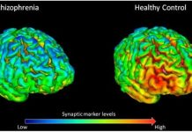 Report: A gut-to-brain circuit drives sugar preference and may explain sugar cravings Report: A gut-to-brain circuit drives sugar preference and may explain sugar cravings