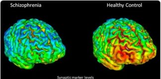 Report: A gut-to-brain circuit drives sugar preference and may explain sugar cravings Report: A gut-to-brain circuit drives sugar preference and may explain sugar cravings