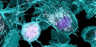 Report: Human Cell Atlas study could help understand transmission of the virus Report: Human Cell Atlas study could help understand transmission of the virus
