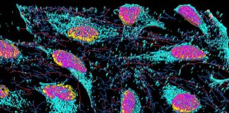 Research finds evidence for existence of elusive ‘metabolon’ Research finds evidence for existence of elusive 'metabolon'