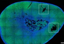 Scientists achieve remote control of hormone release Scientists achieve remote control of hormone release