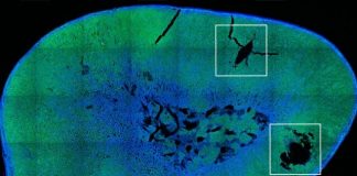 Scientists achieve remote control of hormone release Scientists achieve remote control of hormone release