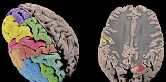 Whole genome sequencing reveals genetic structural secrets of schizophrenia (Study) Whole genome sequencing reveals genetic structural secrets of schizophrenia (Study)
