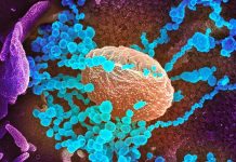 Antibody blocks infection by the SARS-CoV-2 in cells, says new research Antibody blocks infection by the SARS-CoV-2 in cells, says new research