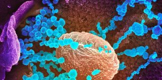 Antibody blocks infection by the SARS-CoV-2 in cells, says new research Antibody blocks infection by the SARS-CoV-2 in cells, says new research
