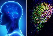 Researchers find brain center that ‘profoundly’ shuts down pain Researchers find brain center that 'profoundly' shuts down pain