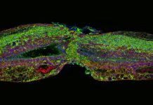Researchers regenerate neurons in mice with spinal cord injury and optic nerve damage Researchers regenerate neurons in mice with spinal cord injury and optic nerve damage
