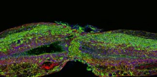 Researchers regenerate neurons in mice with spinal cord injury and optic nerve damage Researchers regenerate neurons in mice with spinal cord injury and optic nerve damage