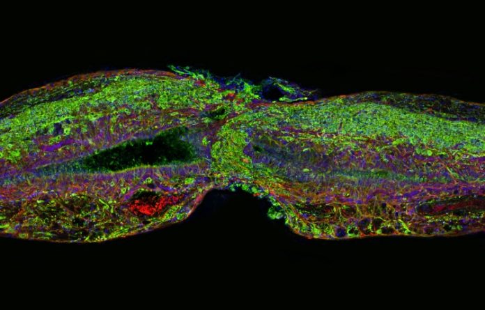 Researchers regenerate neurons in mice with spinal cord injury and optic nerve damage