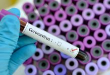 Veterinary college seeks volunteers for COVID-19 study