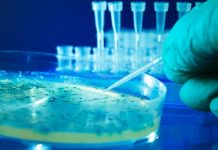 Researchers track how bacteria purge toxic metals (Study)