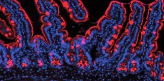 Typhoid’s relative may be key to curing disease