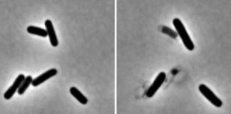 Bacterial enzyme structure opens door for new antibiotics