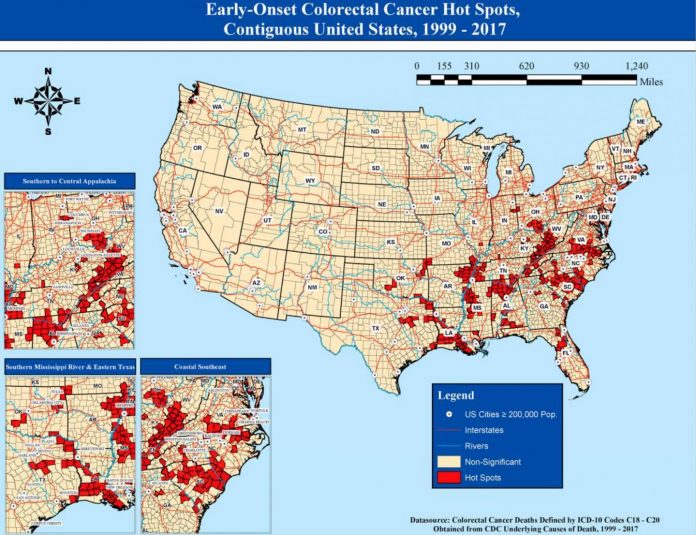 Early-onset colorectal cancer study in young adult men reveals 'hotspots' of death in US