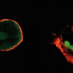 Implants: Can special coatings reduce complications after implant surgery? Implants: Can special coatings reduce complications after implant surgery?