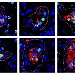 Clues to COVID-19 complications come from NET-like inflammatory response Clues to COVID-19 complications come from NET-like inflammatory response