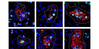 Clues to COVID-19 complications come from NET-like inflammatory response Clues to COVID-19 complications come from NET-like inflammatory response