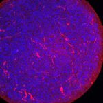 Lab-grown ‘mini-brains’ suggest COVID-19 virus can infect human brain cells Lab-grown 'mini-brains' suggest COVID-19 virus can infect human brain cells