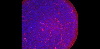 Lab-grown ‘mini-brains’ suggest COVID-19 virus can infect human brain cells Lab-grown 'mini-brains' suggest COVID-19 virus can infect human brain cells