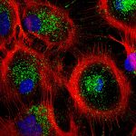 Osmotic stress identified as stimulator of cellular waste disposal Osmotic stress identified as stimulator of cellular waste disposal