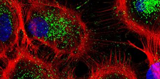Osmotic stress identified as stimulator of cellular waste disposal Osmotic stress identified as stimulator of cellular waste disposal