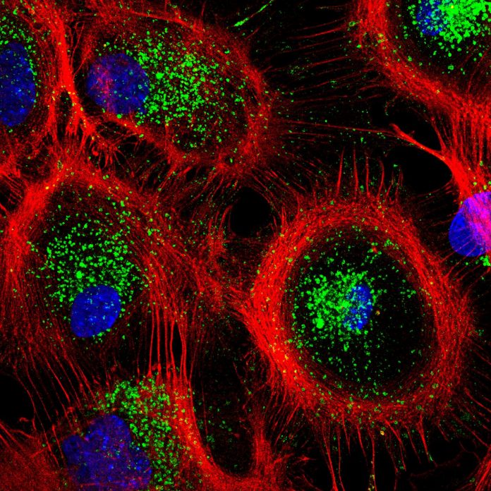 Osmotic stress identified as stimulator of cellular waste disposal