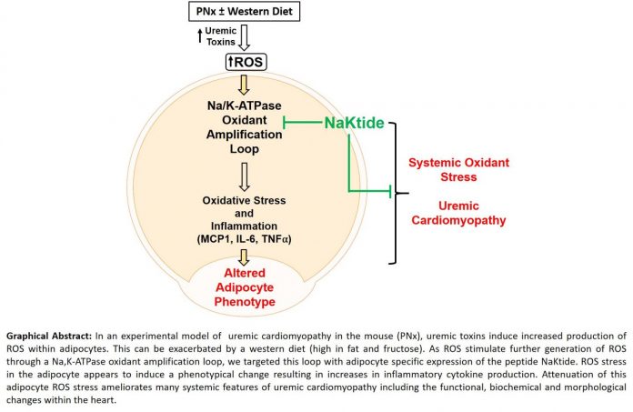 Fat cells found to play a central role in renal failure-associated cardiomyopathy