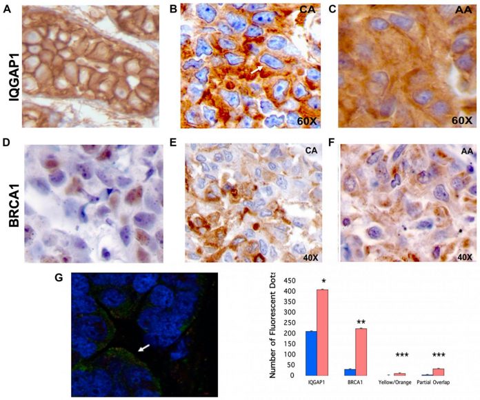 Oncotarget: IQGAP1 control of centrosome function defines variants of breast cancer