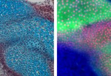 Hints at jaw evolution found in marsupials and monotremes (Study) Hints at jaw evolution found in marsupials and monotremes